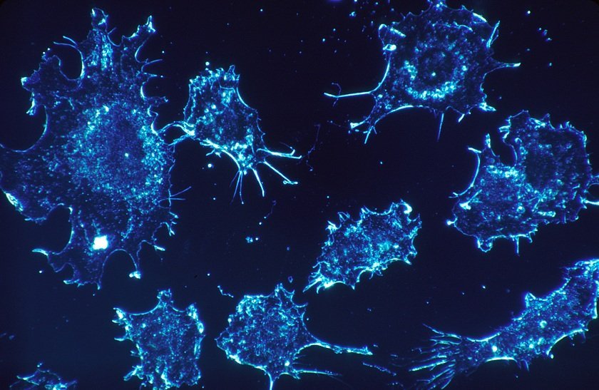 Smartphone Spectrometer To Detect Cancer